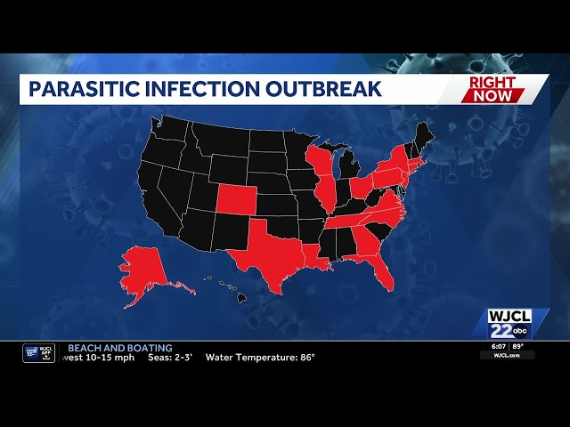Parasite that causes severe diarrhea a linked to fresh produce, CDC investigates cases in Georgia