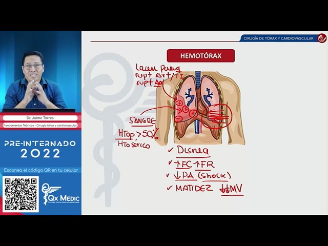 PRE INTERNADO 2022 - Fundamentos teóricos - Cirugía de tórax y cardiovascular