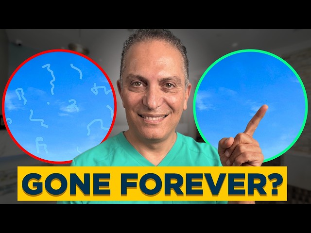 How to get rid of Eye Floaters? | EYE DOCTOR ADVICE