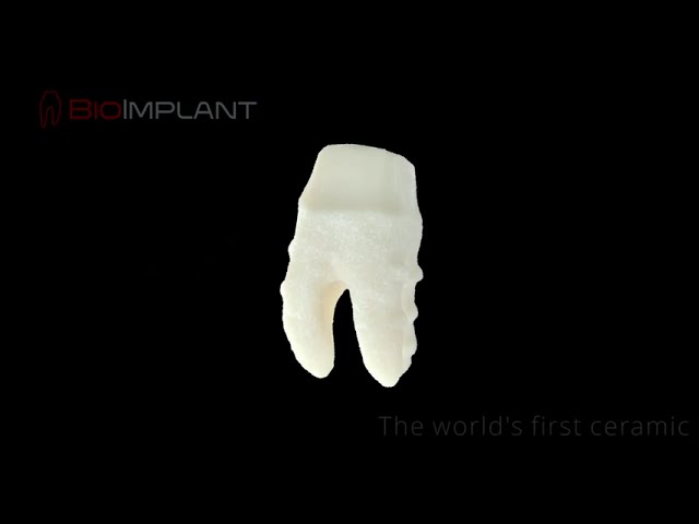 IMMEDIATE CERAMIC DENTAL IMPLANT
