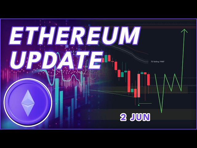 WHY ETH WILL SURPRISE EVERYONE! (Ethereum Update)