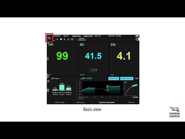 Starling™ SV 5.5 Software Training Module #1