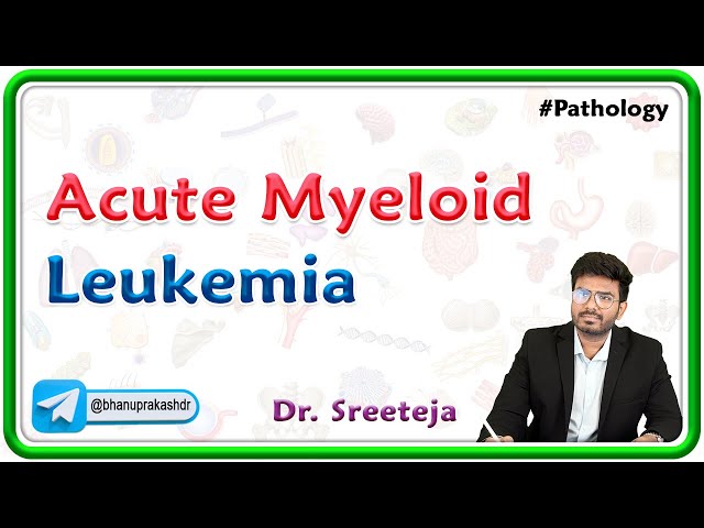 16. Acute Myeloid Leukemia | USMLE Step 1 Pathology