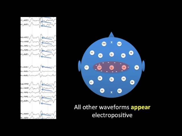 EEG Montages