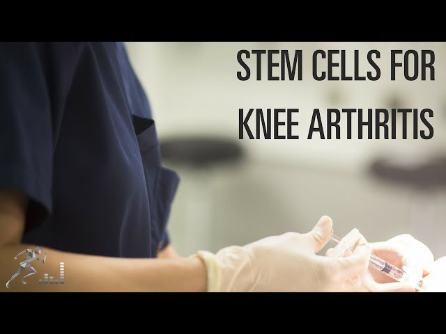 Are stem cells for knee arthritis helpful?