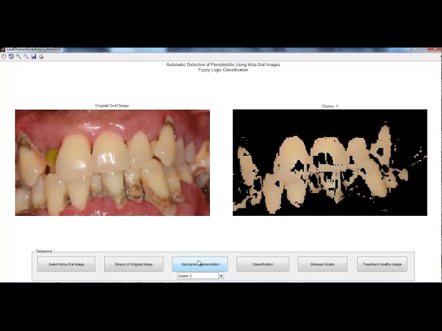 image processing projects list | image processing thesis list | image processing projects code list