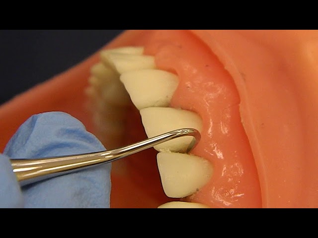 How to Use Sickle Scalers