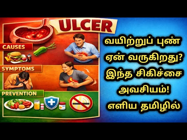 வயிற்றுப் புண் சிகிச்சை! ULCER –முழு தீர்வு. மருத்துவ சிகிச்சைTreatment Doctor Recommended Treatment