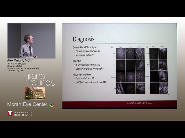 Limbal Stem Cell Deficiency [ARCHIVE]