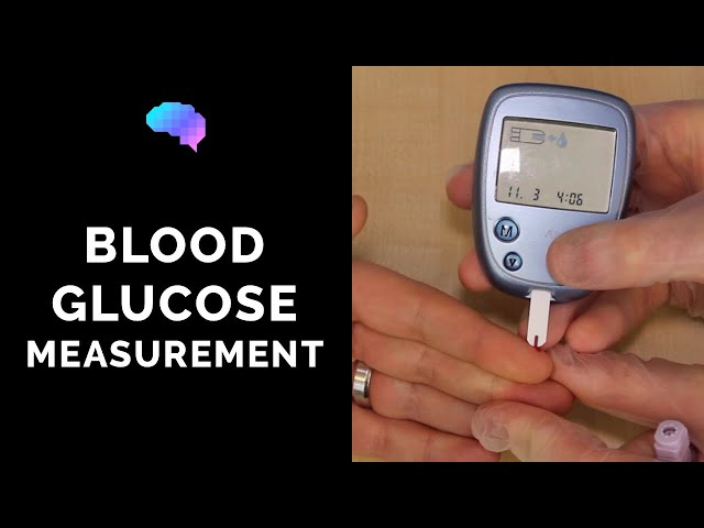 Blood Glucose Measurement | CBG | OSCE Guide | UKMLA | CPSA | PLAB 2