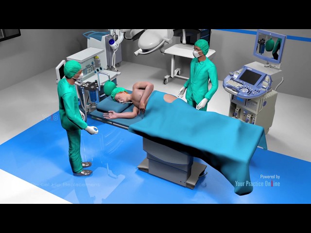 Partial Hip Replacement