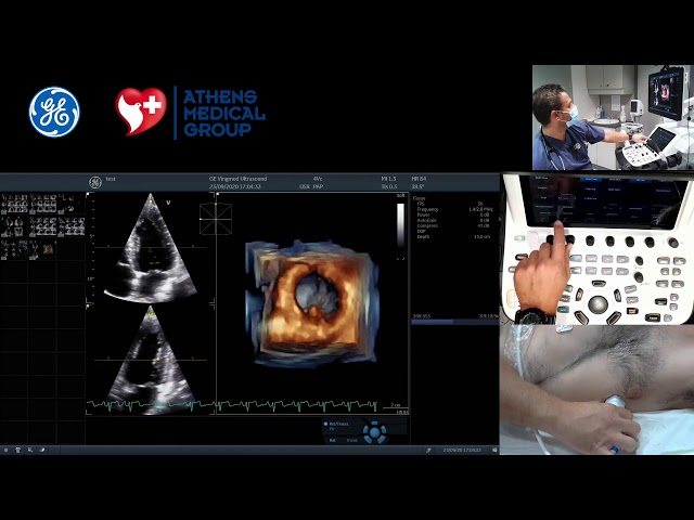 4D tutorials: 5. How to acquire 4D mitral valve views