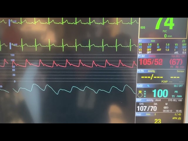 ICU Bedside Monitor Tutorial