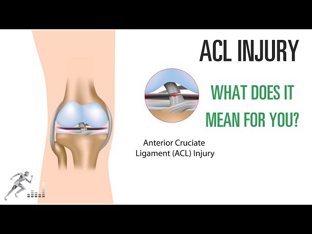ACL injury: What does it mean for you?