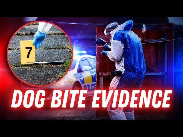 Dog Bite Links Suspect to Violent Home Invasion | Forensics: The Real CSI