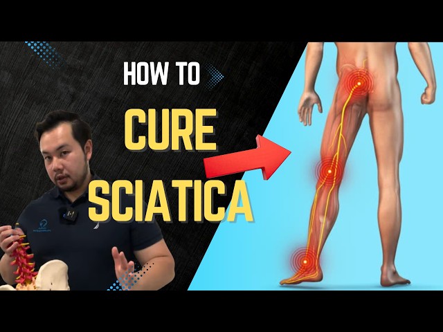 This is how you CURE sciatica.