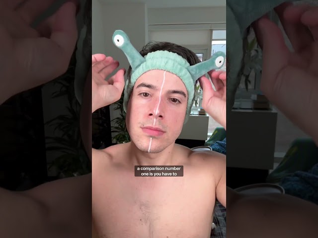 who else is struggles with facial redness?