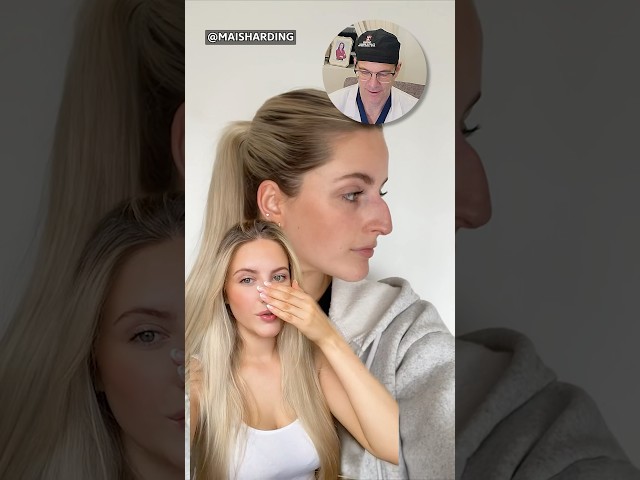 Incredible Nose Job Transformation- Surgeon Reacts