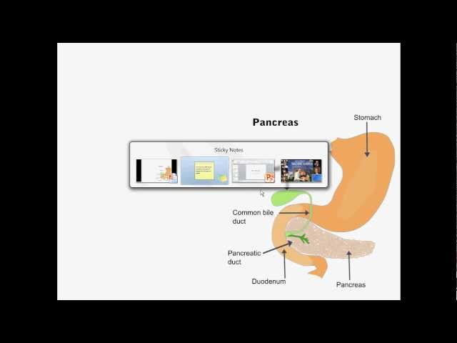 Pancreatic Cancer - USMLE Step 2 Review