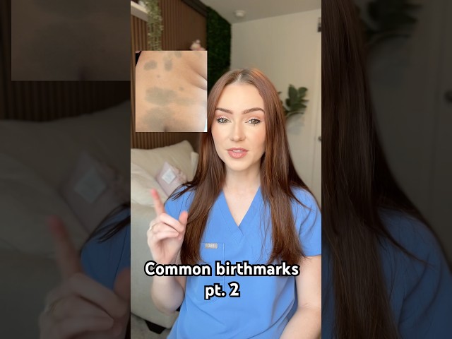 Common birthmarks pt. 2 🔎 #dermatology #birthmark #skinhealth #nevus #physicianassistant