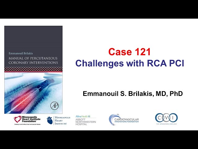 Case 121: PCI Manual - Challenges with RCA PCI