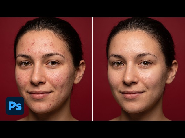 Remove Acne & Blemishes in Seconds with Photoshop AI