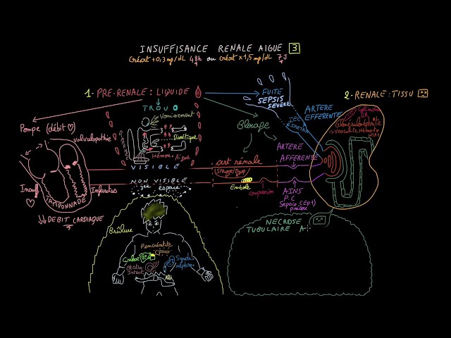 Acute Renal Failure - Doctor Synapse