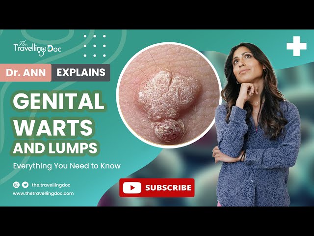 HPV Warts Explained: Signs, Creams, and When to Worry