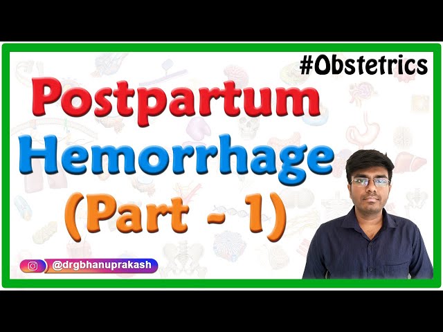 𝐏𝐨𝐬𝐭𝐩𝐚𝐫𝐭𝐮𝐦 𝐇𝐞𝐦𝐨𝐫𝐫𝐡𝐚𝐠𝐞 - part 1 || Obstetrics & gynaecology