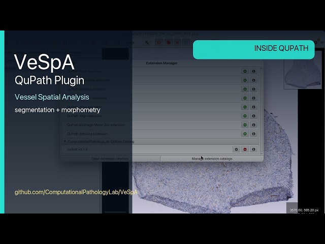 VeSpA QuPath Plugin: Vessel Spatial Analysis for Digital Pathology