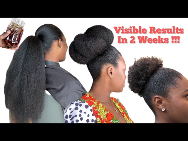 Chronic Hair Fall, Alopecia,  Breakage , Thinning, YOUR SOLUTION JUST DROPPED