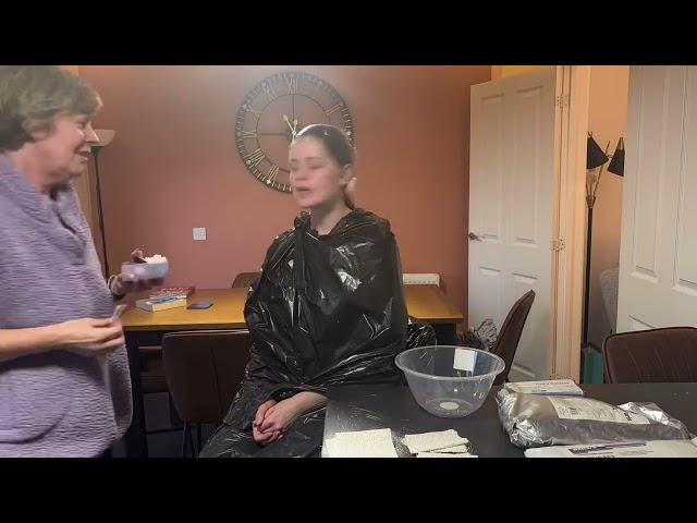 Lifecast and Removal