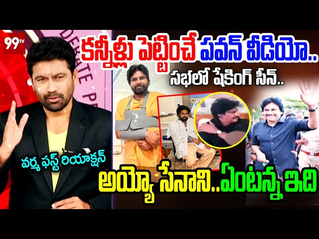 పవన్ కి ఏమైంది?.. Varma First Reaction On Pawan Kalyan Arm Operation Problem | 99TV Telugu
