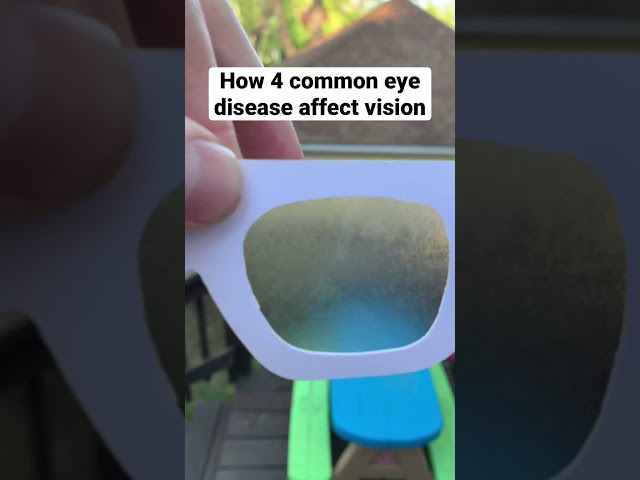 Eye Diseases Vision Simulation