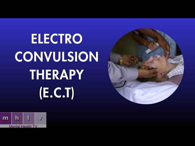 Electro Convulsion Therapy (E.C.T)