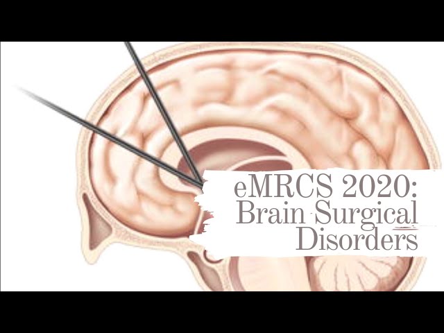 eMRCS 2020: Brain Surgical Disorders