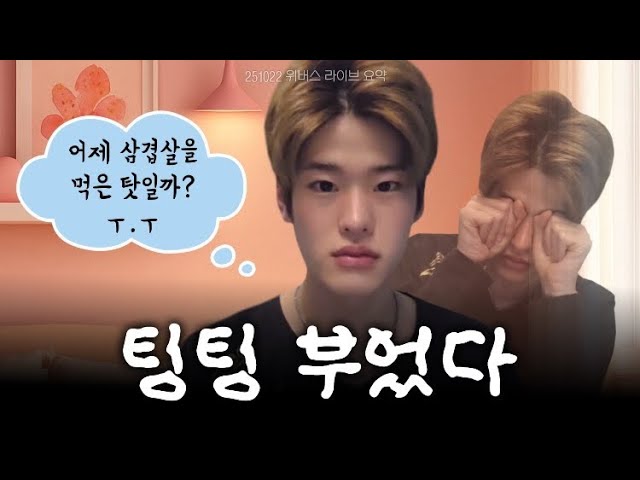 [라이즈 소희] 벌쏘견이 됐지만 라방은 하고 싶어ㅠ.ㅠ (251022 위버스 라이브)