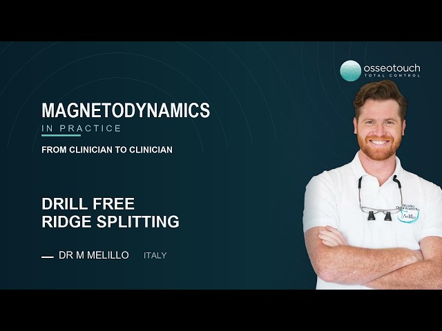 Mallet Shot: Drill-Free Ridge Splitting with Magnetic Mallet | Dr. Michele Melillo