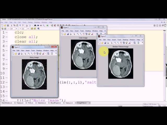 Image Processing in Matlab Part 3:  Noise And Filtering