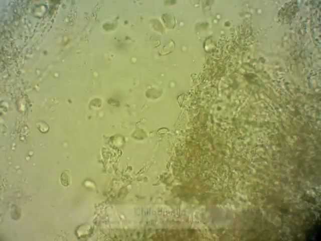 Common Koi Parasites - Chilodonella