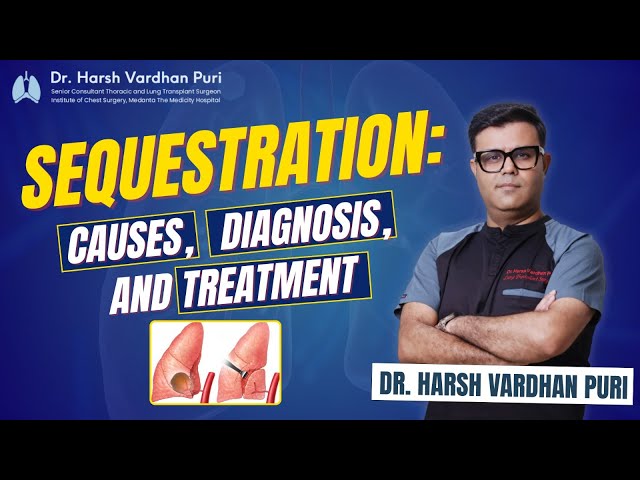 Sequestration: Causes, Diagnosis, and Treatment
