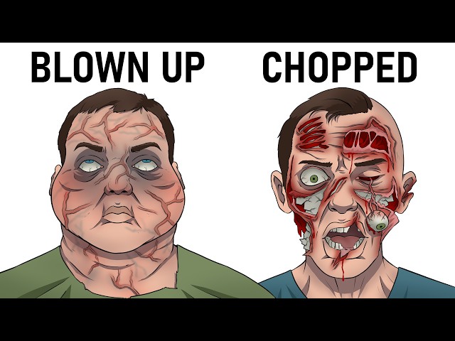 The Most Brutal Factory Accidents Ever