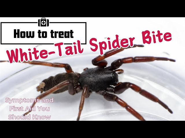White-Tail Spider: Facts, Myths, and Bite Treatment