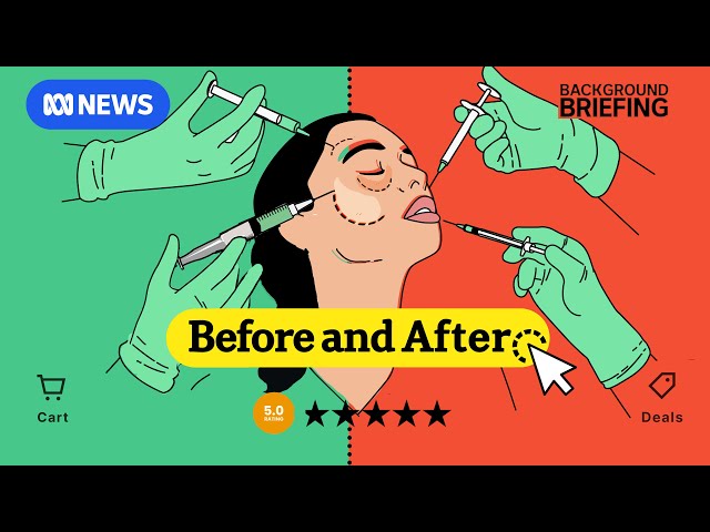 Under your skin | Before and After - Episode 3 | BB investigates the injectable industry