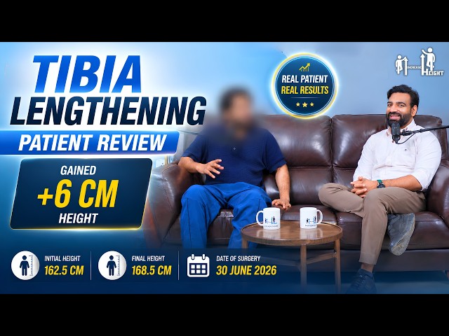 +6 CM Height Gain After Tibia Leg Lengthening Surgery in India | Patient Review | 162.5 to 168.5 CM