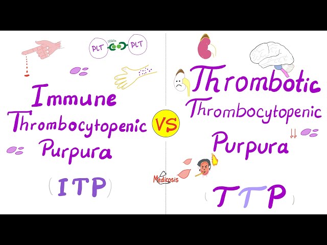 ITP vs TTP (Immune Thrombocytopenic purpura vs Thrombotic Theombocytopenic Purpura)