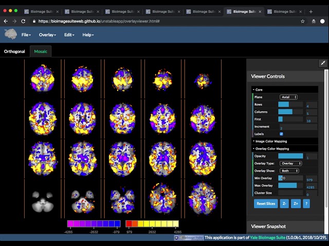 BioImage Suite Web Introduction Video