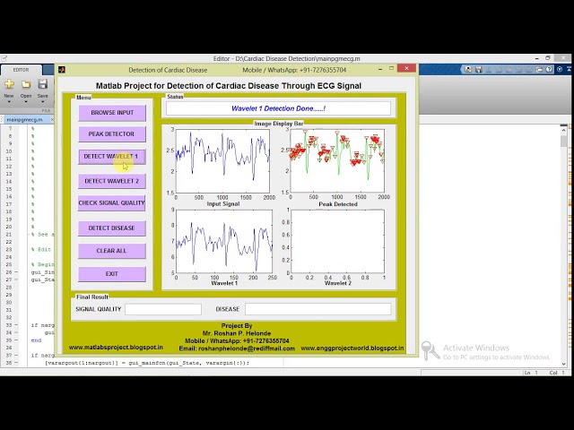 Matlab Project for Detection of Cardiac Disease from ECG Signal Data Source Code || IEEE Project