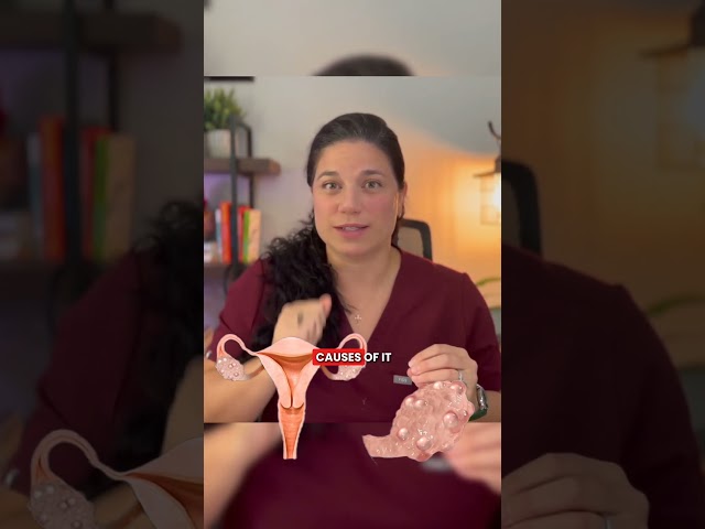 What Type of PCOS Do You Have? Know the 4 Types #pcosawareness