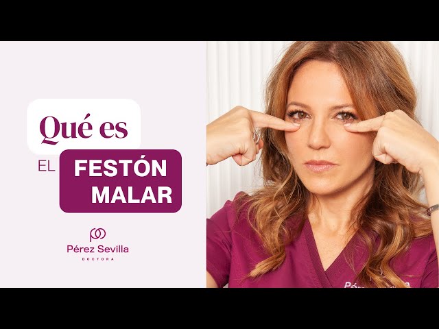 Festón malar - Clínica Dra. Pérez Sevilla